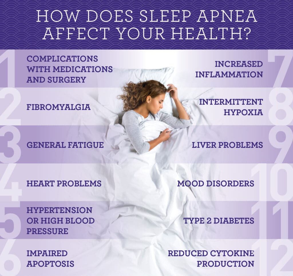 Sleep apnea study